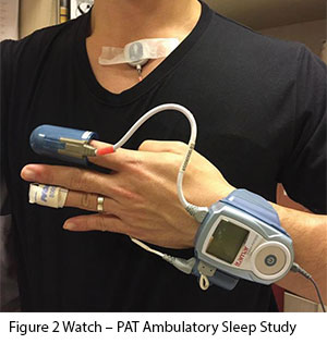 Obesity and Obstructive Sleep Apnoea - Watch - PAT Ambulatory Sleep Study