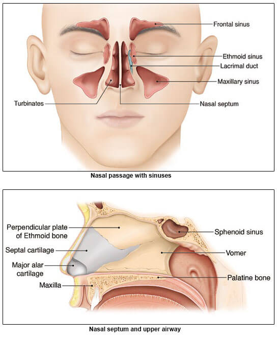 Nasal surgery to treat Obstructive Sleep Apnoea (OSA) - Obstructive Sleep Apnoea (OSA) Conditions and Treatments